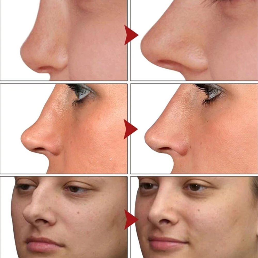 ⁦Nose Lifting & Collagen Boosting Oil⁩ - الصورة ⁦2⁩