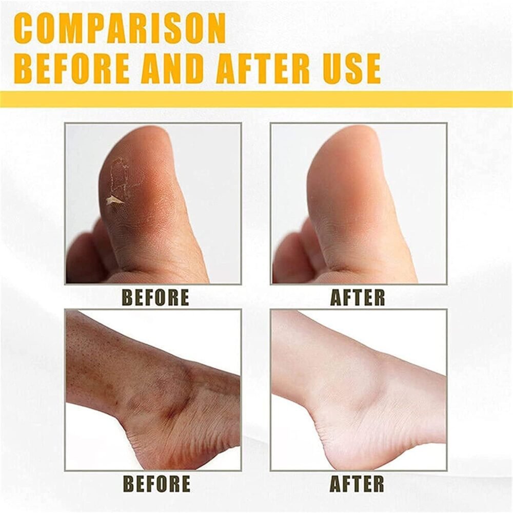 ⁦Magic Dead Skin Peeling Oil⁩ - الصورة ⁦6⁩