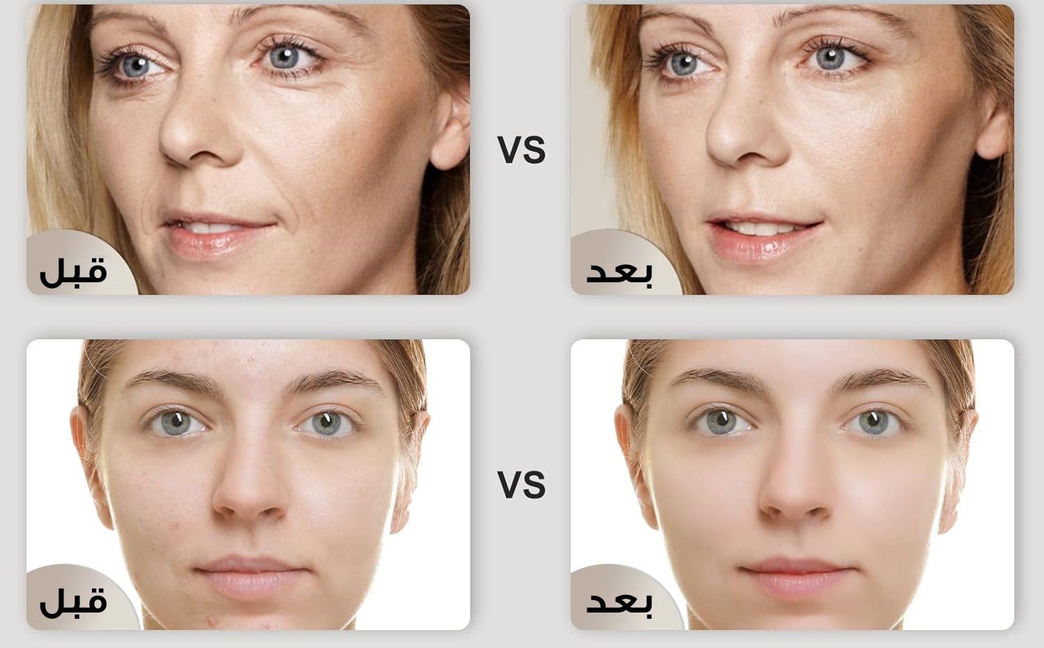 جهاز ليزر لبشرة زجاجية - الصورة 2